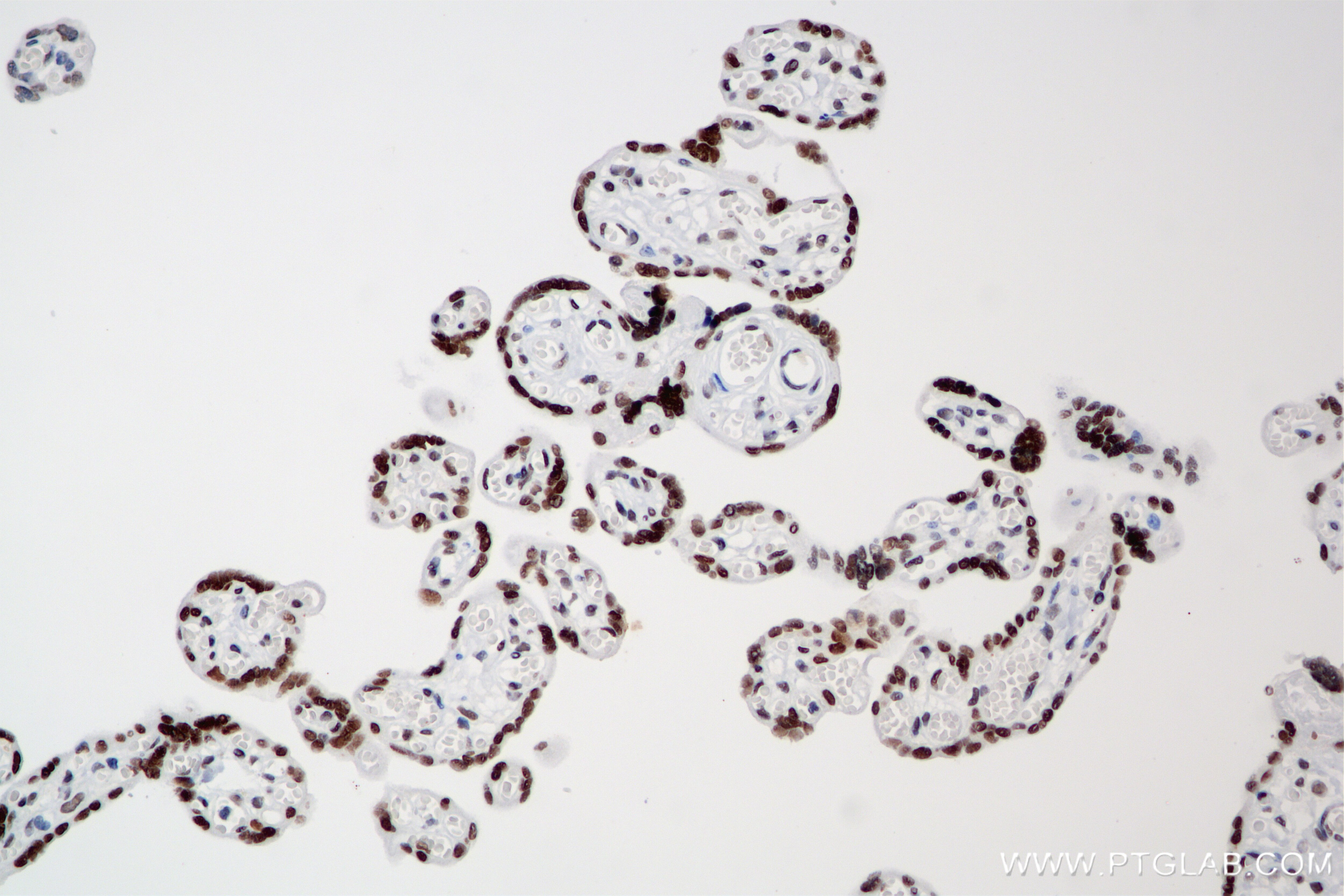 Immunohistochemical analysis of paraffin-embedded human placenta tissue slide using 85019-3-RR (SMARCA5 antibody) at dilution of 1:500 (under 20x lens). Heat mediated antigen retrieval with Tris-EDTA buffer (pH 9.0). Immunohistochemistry (IHC) staining of human placenta tissue using SMARCA5 Recombinant antibody (85019-3-RR)