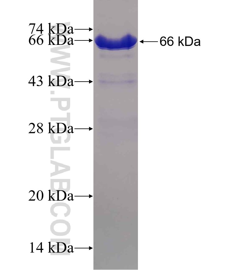 SMARCA5 fusion protein Ag3759 SDS-PAGE