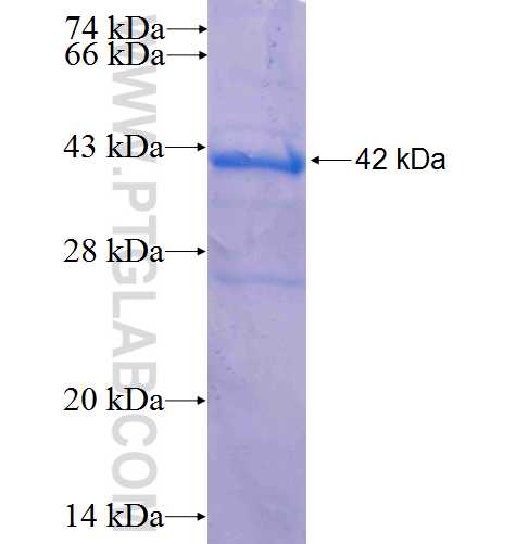 SMARCAD1 fusion protein Ag5281 SDS-PAGE