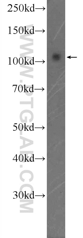 Western Blot (WB) analysis of Jurkat cells using SMARCAL1 Polyclonal antibody (12513-1-AP)