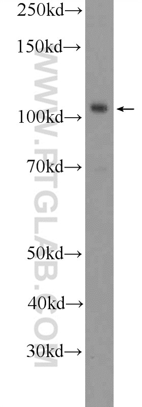 Western Blot (WB) analysis of HEK-293 cells using SMARCAL1 Polyclonal antibody (12513-1-AP)