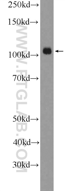 Western Blot (WB) analysis of HEK-293 cells using SMARCAL1 Polyclonal antibody (12513-1-AP)