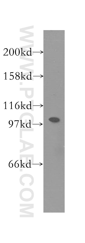 Western Blot (WB) analysis of Jurkat cells using SMARCAL1 Polyclonal antibody (12513-1-AP)