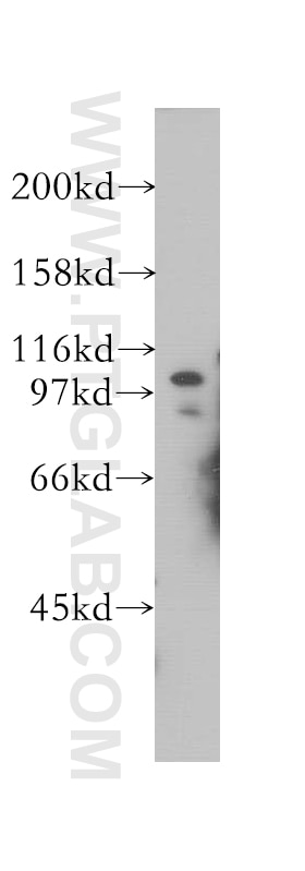 Western Blot (WB) analysis of mouse testis tissue using SMARCAL1 Polyclonal antibody (12513-1-AP)