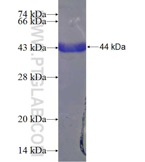 SMARCAL1 fusion protein Ag23707 SDS-PAGE