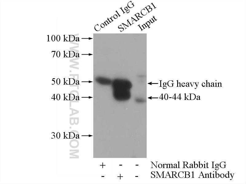 Immunoprecipitation (IP) experiment of K-562 cells using SMARCB1 Polyclonal antibody (20654-1-AP)