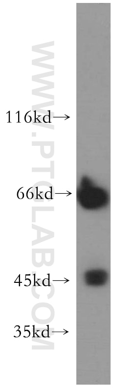 Western Blot (WB) analysis of K-562 cells using SMARCB1 Polyclonal antibody (20654-1-AP)