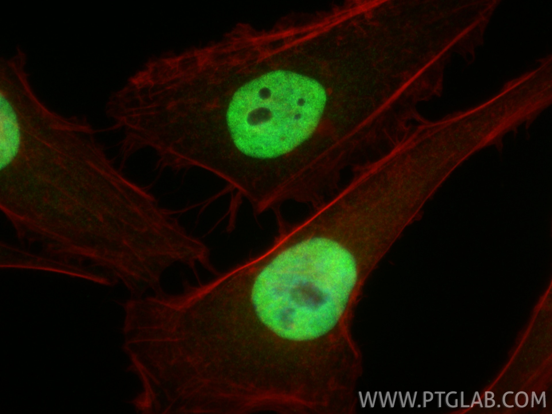 IF Staining of HeLa using 17722-1-AP Immunofluorescence (IF) / fluorescent staining of HeLa cells using SMARCC1 Polyclonal antibody (17722-1-AP)