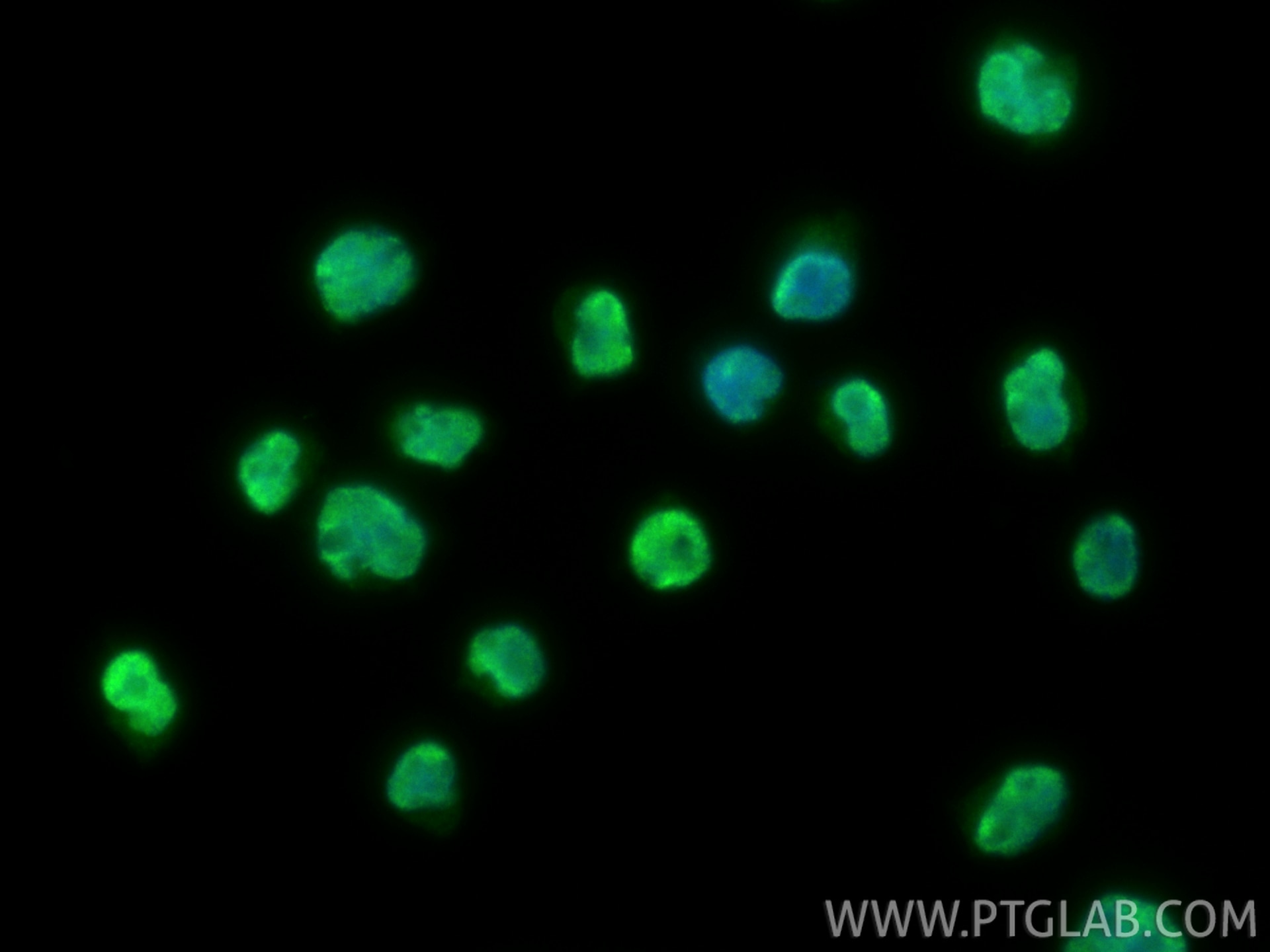 IF Staining of Jurkat using 17722-1-AP Immunofluorescence (IF) / fluorescent staining of Jurkat cells using SMARCC1 Polyclonal antibody (17722-1-AP)