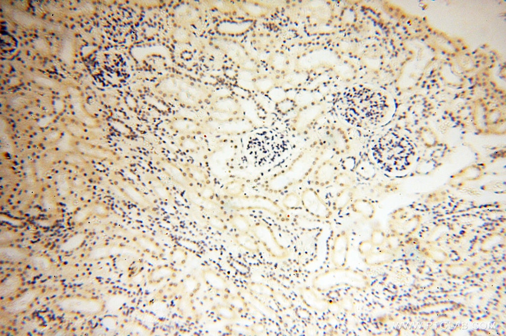 Immunohistochemistry (IHC) staining of human kidney tissue using SMARCC1 Polyclonal antibody (17722-1-AP)
