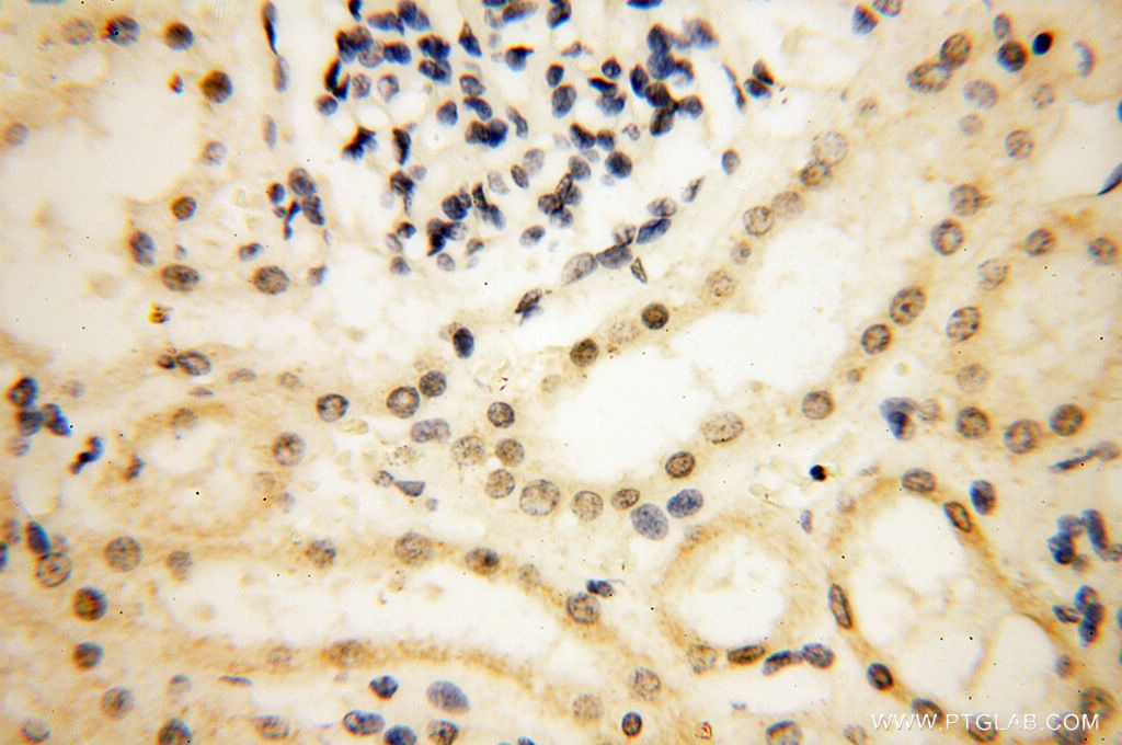 Immunohistochemistry (IHC) staining of human kidney tissue using SMARCC1 Polyclonal antibody (17722-1-AP)