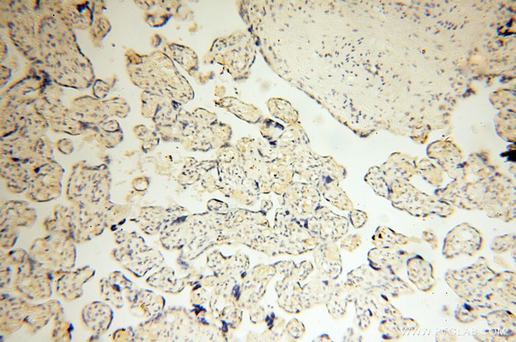 Immunohistochemistry (IHC) staining of human placenta tissue using SMARCC1 Polyclonal antibody (17722-1-AP)