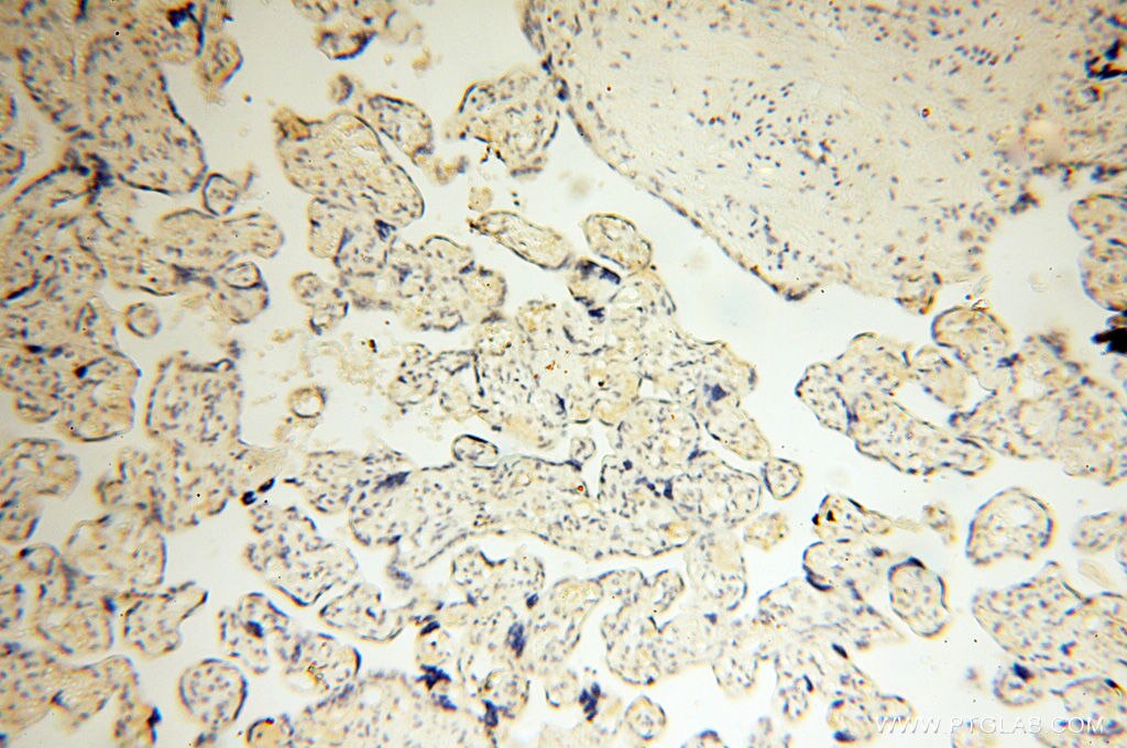 IHC staining of human placenta using 17722-1-AP