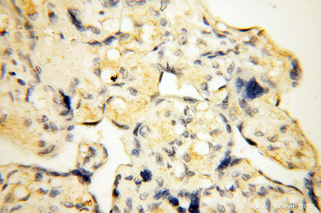 Immunohistochemistry (IHC) staining of human placenta tissue using SMARCC1 Polyclonal antibody (17722-1-AP)