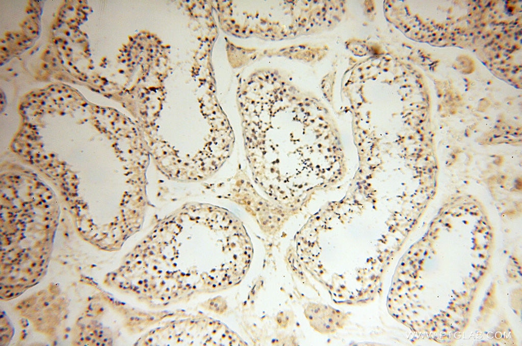 Immunohistochemistry (IHC) staining of human testis tissue using SMARCC1 Polyclonal antibody (17722-1-AP)