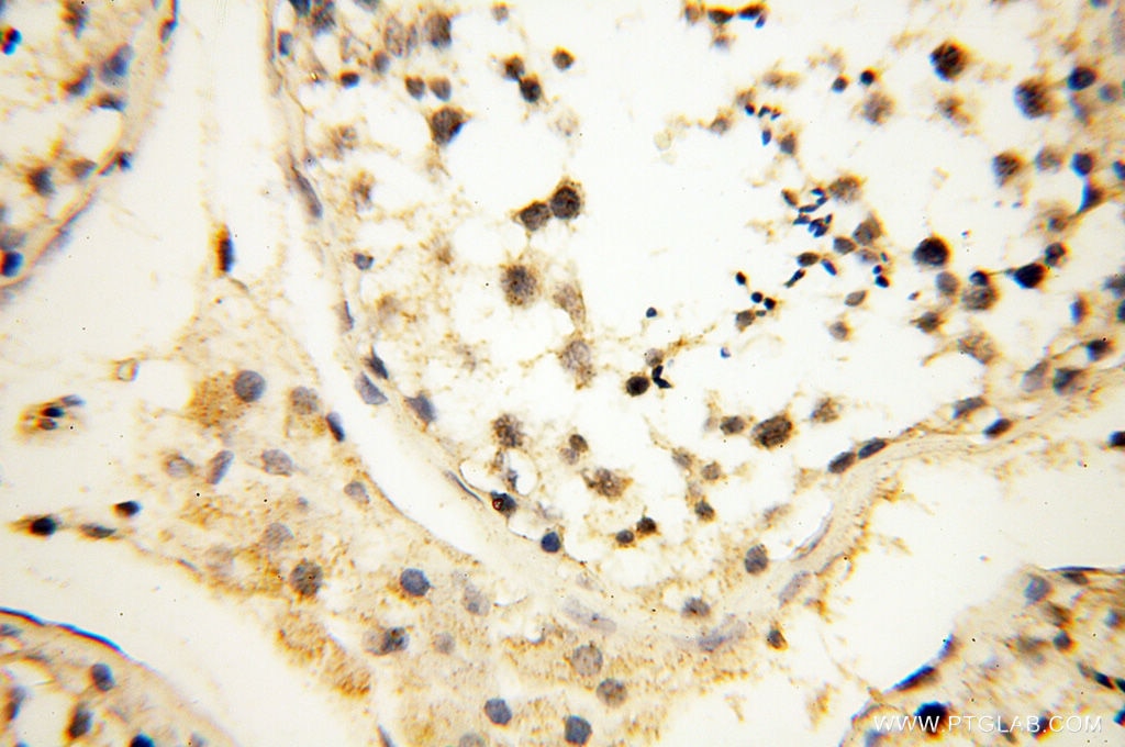 Immunohistochemistry (IHC) staining of human testis tissue using SMARCC1 Polyclonal antibody (17722-1-AP)