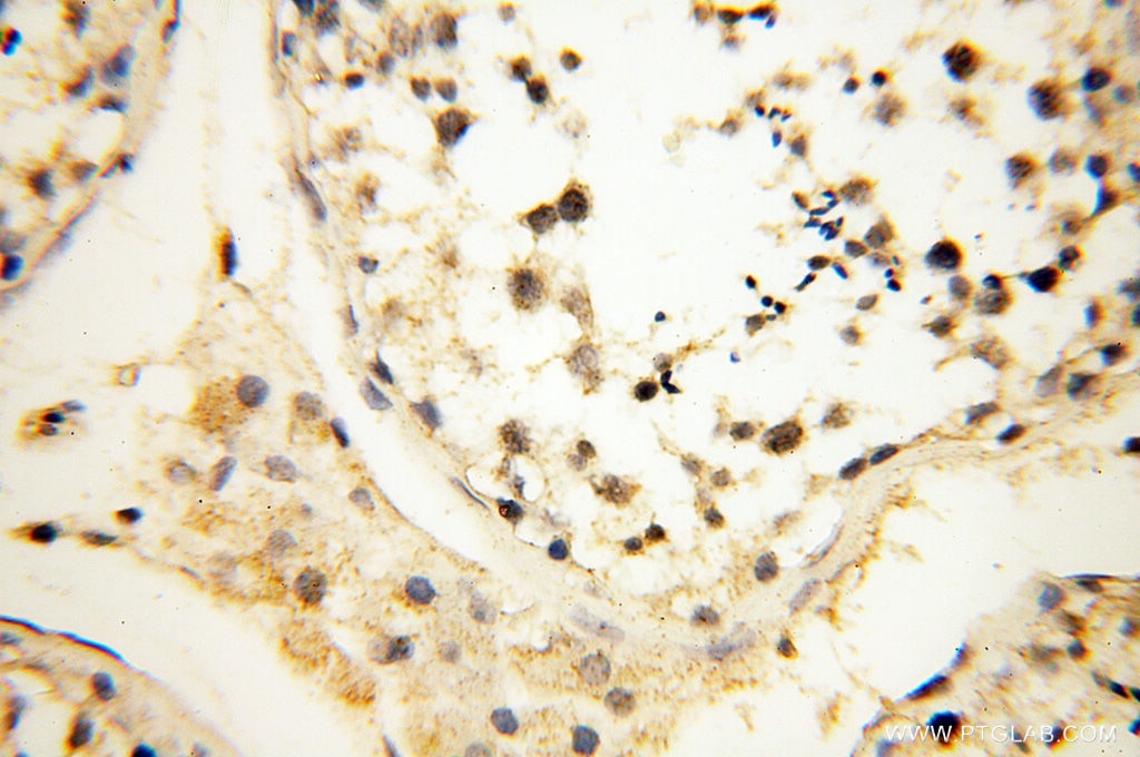 IHC staining of human testis using 17722-1-AP