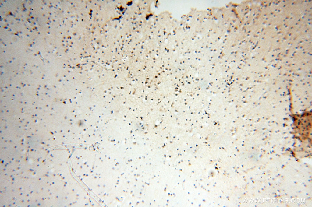 Immunohistochemistry (IHC) staining of human brain tissue using SMARCC1 Polyclonal antibody (17722-1-AP)