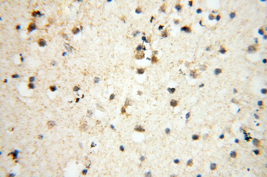 Immunohistochemistry (IHC) staining of human brain tissue using SMARCC1 Polyclonal antibody (17722-1-AP)