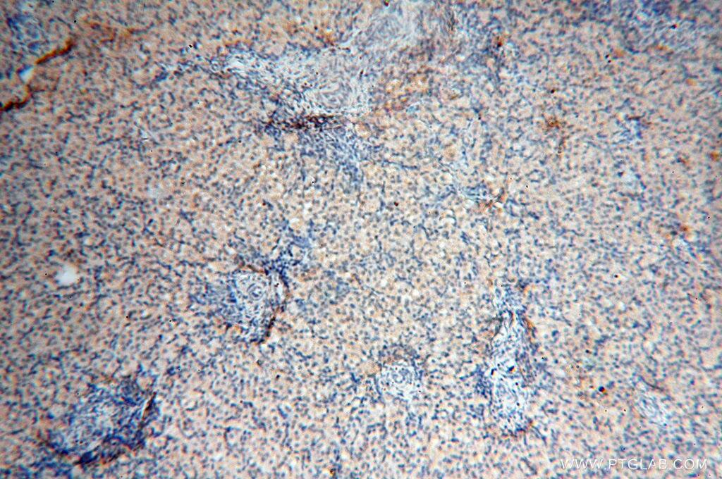 Immunohistochemistry (IHC) staining of human ovary tissue using SMARCC1 Polyclonal antibody (17722-1-AP)