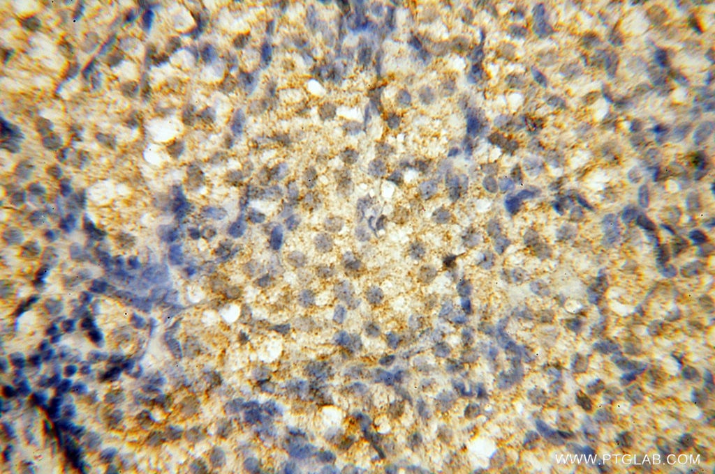 Immunohistochemistry (IHC) staining of human ovary tissue using SMARCC1 Polyclonal antibody (17722-1-AP)