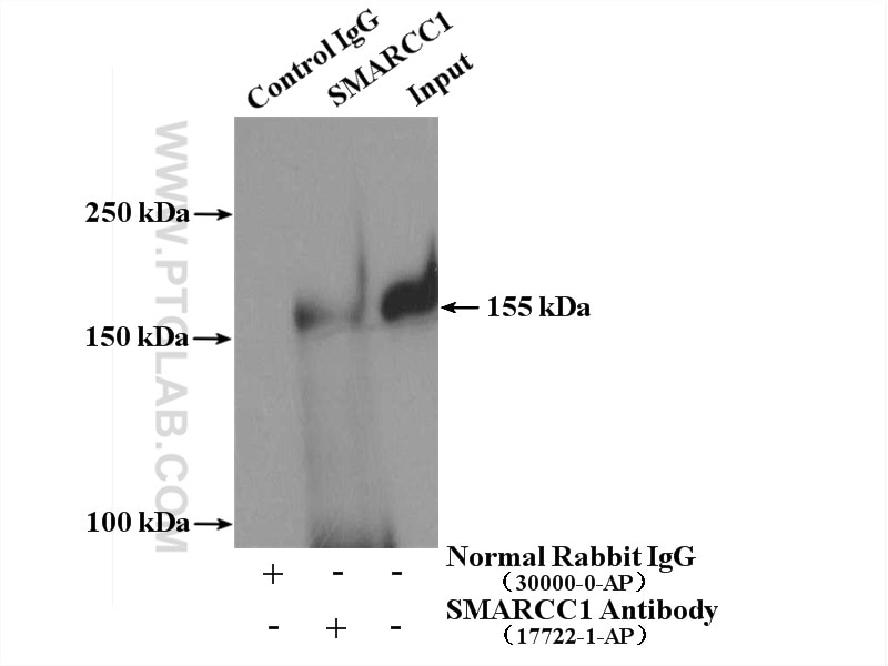Immunoprecipitation (IP) experiment of mouse brain tissue using SMARCC1 Polyclonal antibody (17722-1-AP)