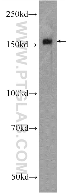 WB analysis of rat brain using 17722-1-AP