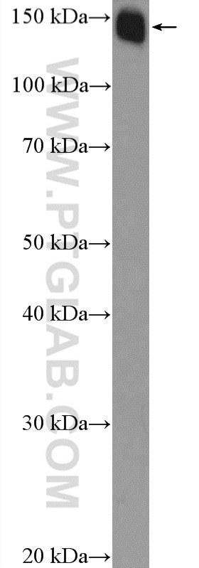 Western Blot (WB) analysis of rat testis tissue using SMARCC1 Polyclonal antibody (17722-1-AP)