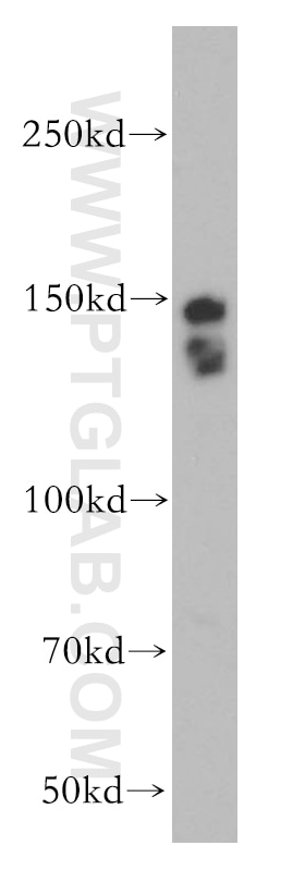 Western Blot (WB) analysis of Jurkat cells using SMARCC1 Polyclonal antibody (17722-1-AP)