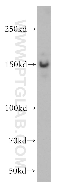 WB analysis of K-562 using 17722-1-AP