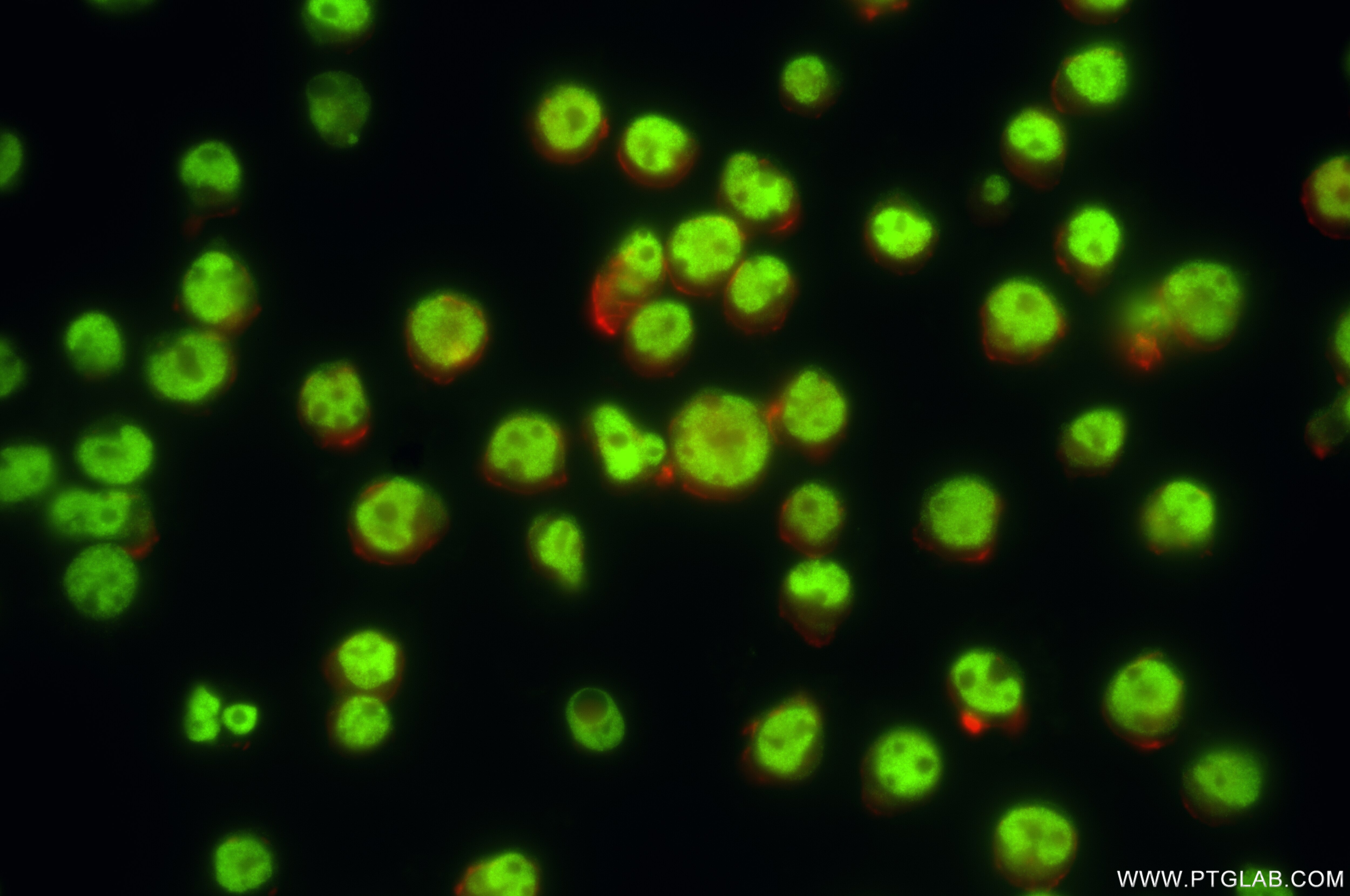Immunofluorescence (IF) / fluorescent staining of Jurkat cells using SMARCC1 Recombinant antibody (86015-1-RR)