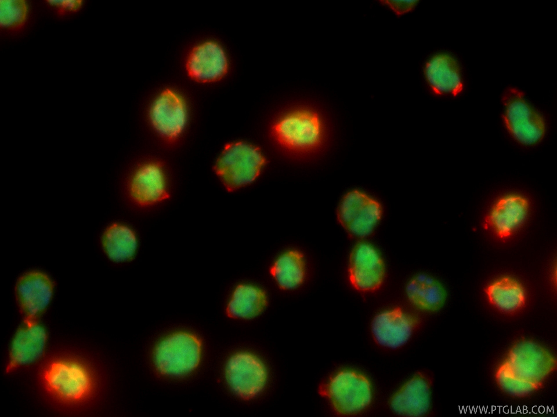 Immunofluorescence (IF) / fluorescent staining of Jurkat cells using CoraLite® Plus 488-conjugated SMARCC1 Recombinant  (CL488-86015)