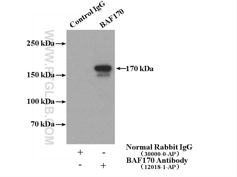 Immunoprecipitation (IP) experiment of HeLa cells using BAF170 Polyclonal antibody (12018-1-AP)
