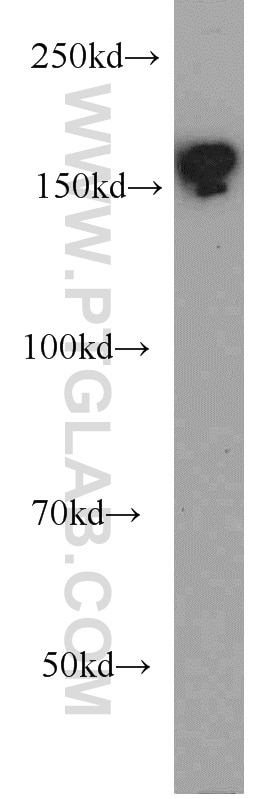 Western Blot (WB) analysis of HeLa cells using BAF170 Polyclonal antibody (12018-1-AP)