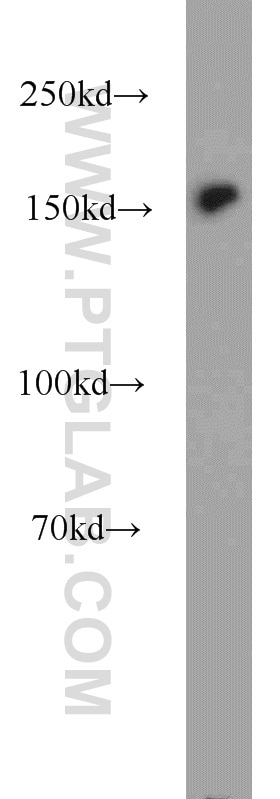 Western Blot (WB) analysis of HeLa cells using BAF170 Polyclonal antibody (12018-1-AP)