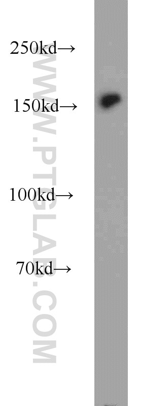 WB analysis of HeLa using 12018-1-AP