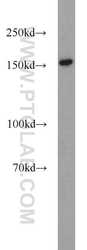 Western Blot (WB) analysis of A431 cells using BAF170 Polyclonal antibody (12018-1-AP)