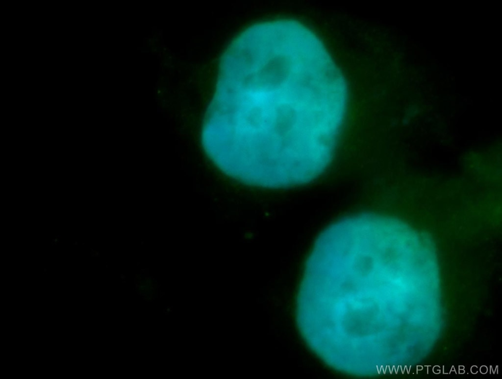 Immunofluorescence (IF) / fluorescent staining of SH-SY5Y cells using SMARCD1 Polyclonal antibody (10998-2-AP)