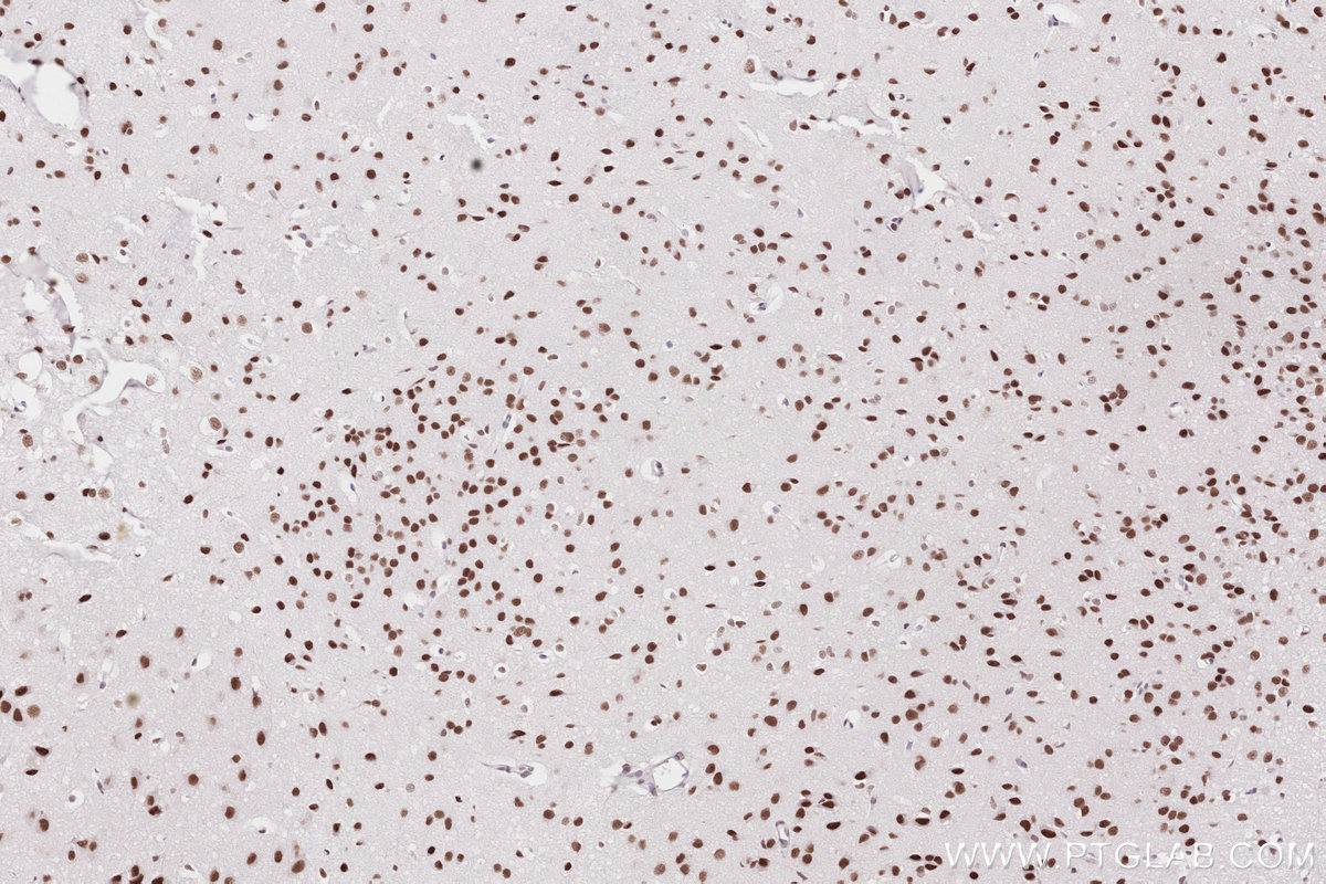 Immunohistochemistry (IHC) staining of mouse brain tissue using SMARCD1 Polyclonal antibody (10998-2-AP)