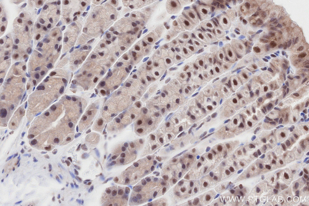 Immunohistochemistry (IHC) staining of mouse stomach tissue using SMARCD1 Polyclonal antibody (10998-2-AP)