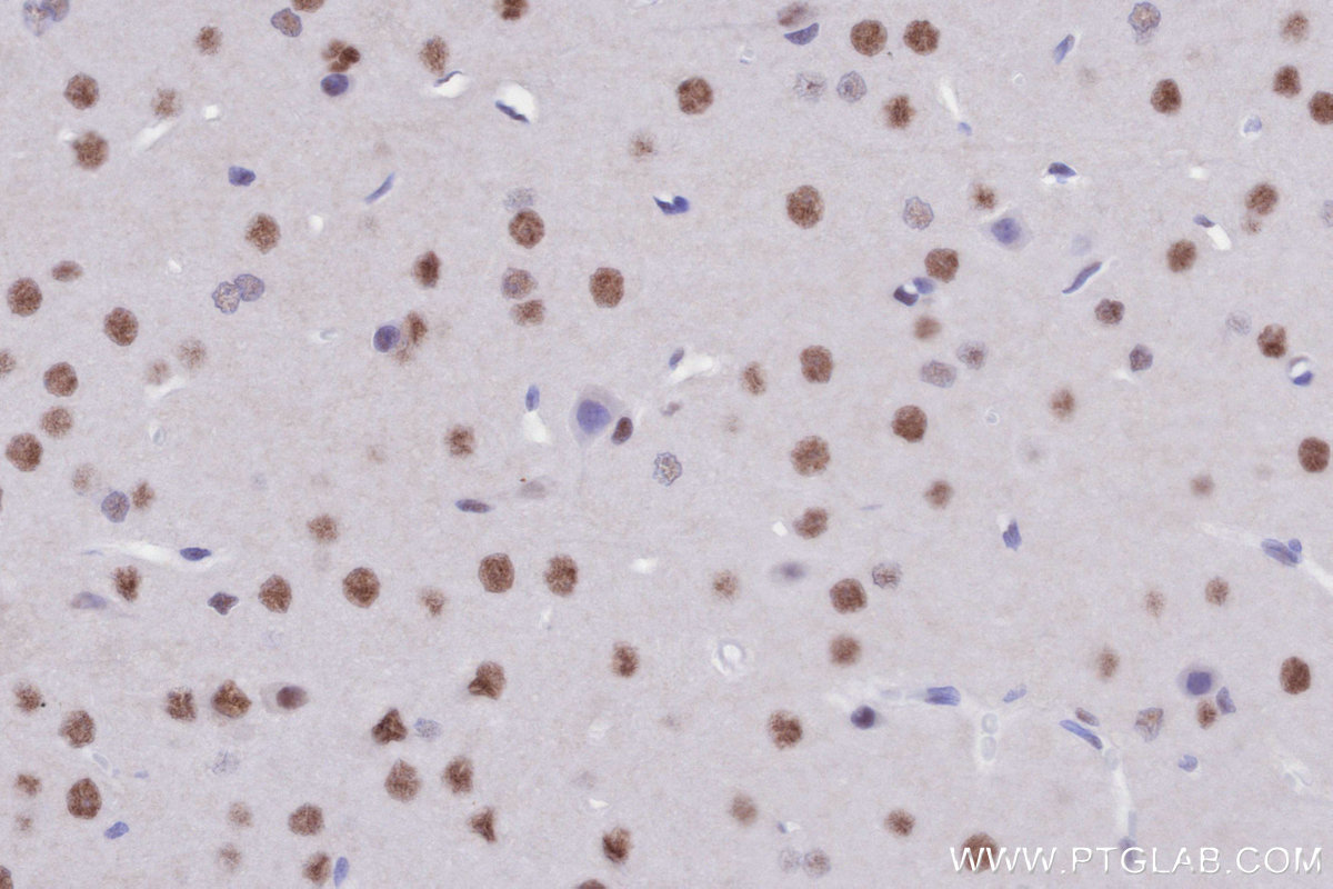 Immunohistochemistry (IHC) staining of rat brain tissue using SMARCD1 Polyclonal antibody (10998-2-AP)