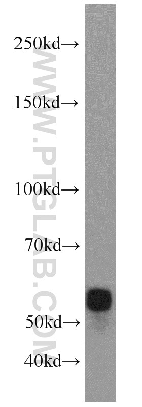 Western Blot (WB) analysis of mouse brain tissue using SMARCD1 Polyclonal antibody (10998-2-AP)