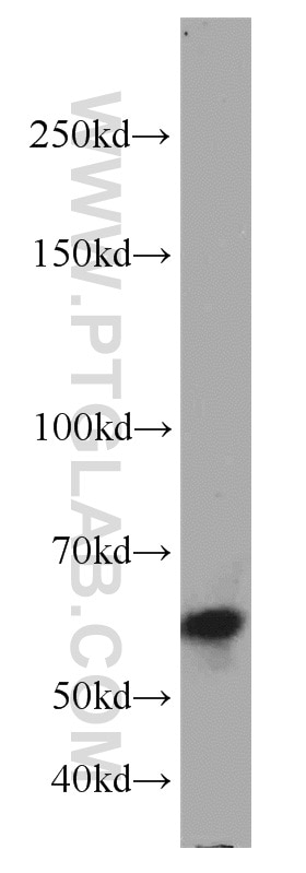 Western Blot (WB) analysis of mouse brain tissue using SMARCD1 Polyclonal antibody (10998-2-AP)