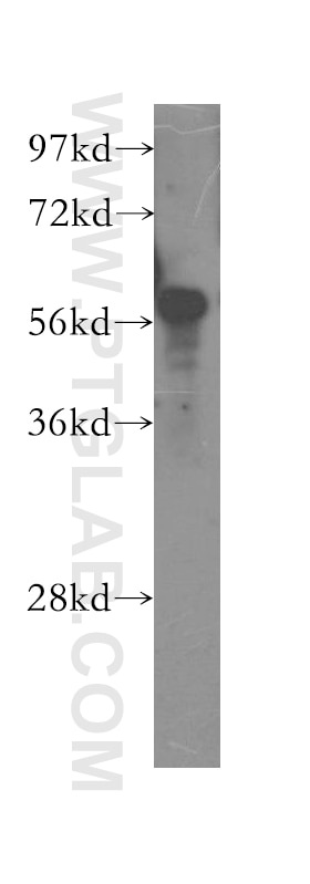 Western Blot (WB) analysis of Jurkat cells using SMARCD1 Polyclonal antibody (10998-2-AP)