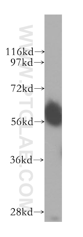Western Blot (WB) analysis of human brain tissue using SMARCD1 Polyclonal antibody (10998-2-AP)