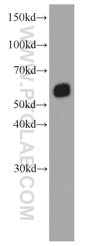 Western Blot (WB) analysis of Jurkat cells using SMARCD1 Monoclonal antibody (66116-1-Ig)