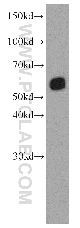 WB analysis of Jurkat using 66116-1-Ig