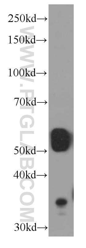 Western Blot (WB) analysis of human brain tissue using SMARCD1 Monoclonal antibody (66116-1-Ig)