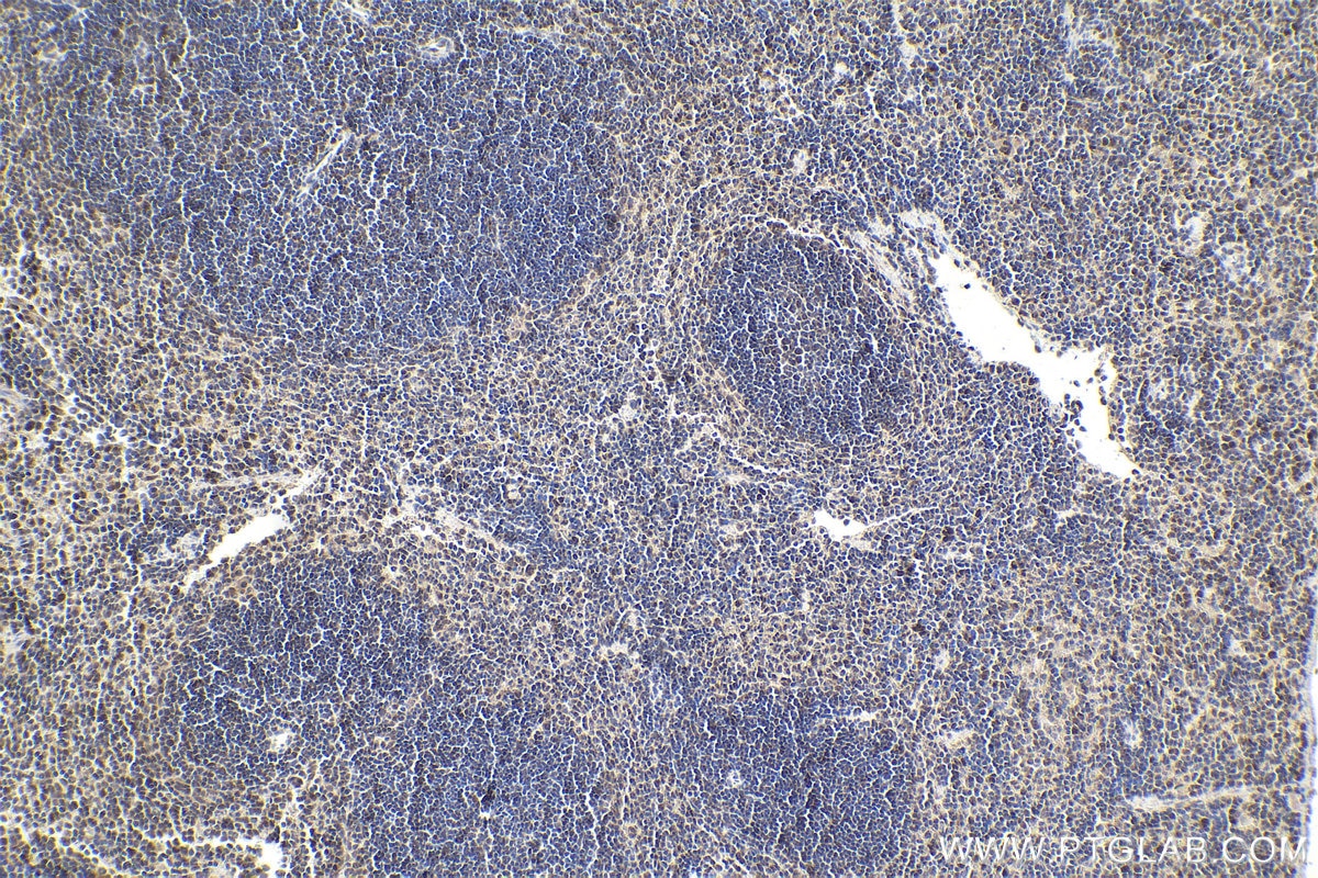 Immunohistochemistry (IHC) staining of mouse spleen tissue using SMARCD2 Polyclonal antibody (11156-1-AP)