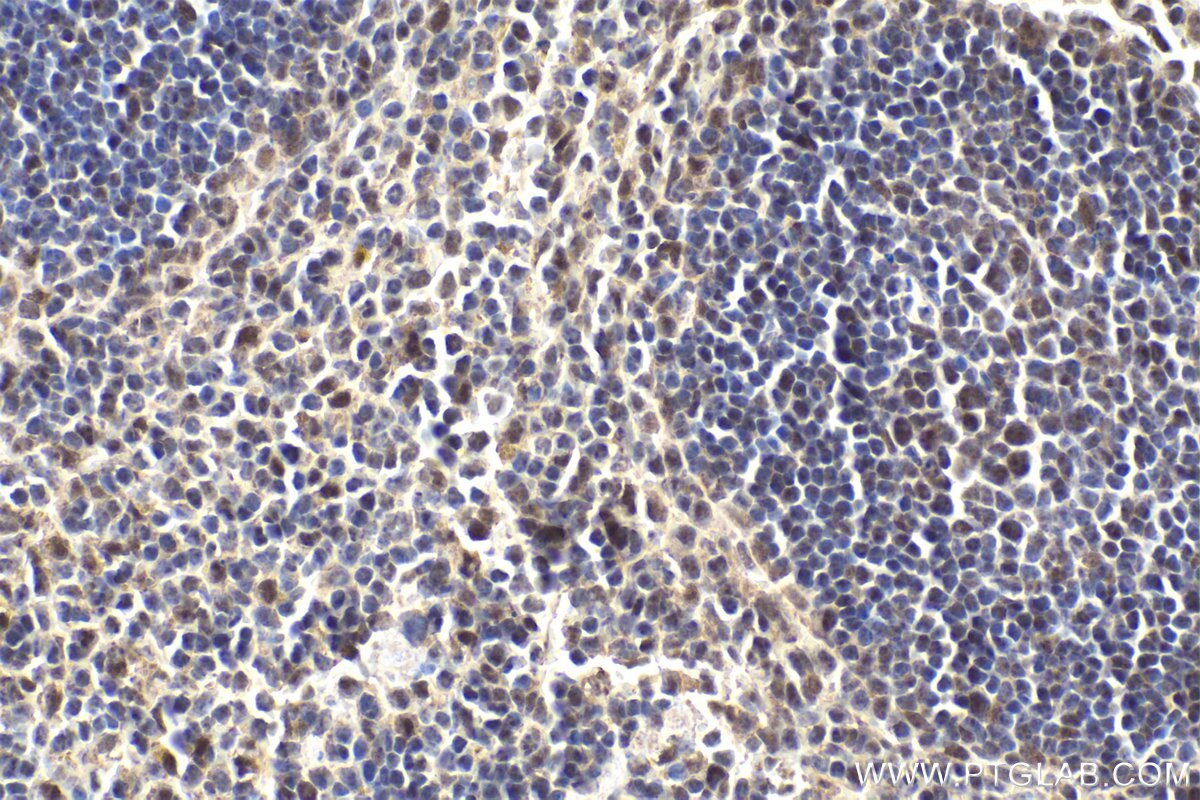 Immunohistochemistry (IHC) staining of mouse spleen tissue using SMARCD2 Polyclonal antibody (11156-1-AP)